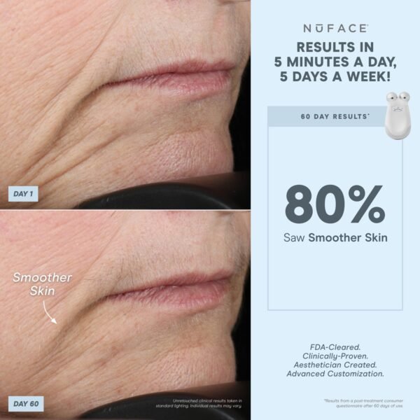 NuFACE Trinity FDA Cleared Microcurrent Facial Device & Wrinkle Reducer Attachment - Microcurrent Device with LED Red Light Attachment - Face Sculpting & Neck Tightening Device + Aqua Microcurrent Gel - Image 2