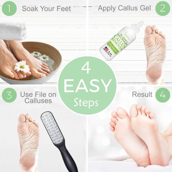 Callus Remover Gel & Double-Sided Foot File: 8 oz Extra Strength Callus Remover for Feet, Foot Callus Remover Care, Pedicure Tools Supplies, Spa Kit, Dead Skin Scrubber - Image 7