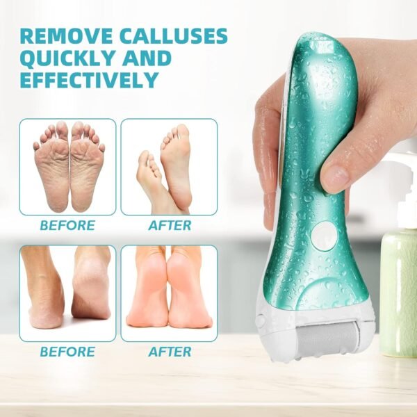 Callus Remover for Feet, Nicebirdie Electric Foot File Callus Removers Rechargeable Waterproof Pedicure Tools Foot Scrubber Shaver Feet Care Tool for Cracked Heels Dead Skin （Green） - Image 6